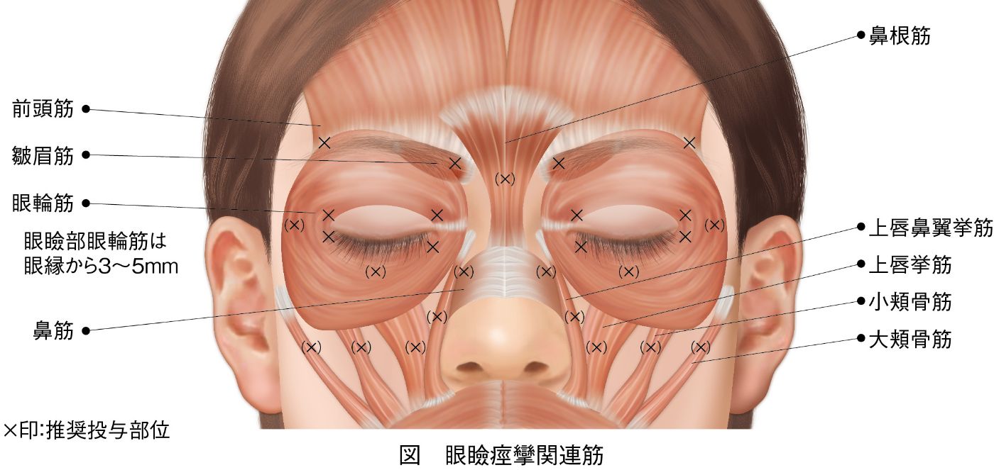 眼瞼痙攣関連筋