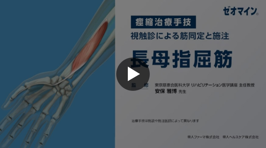 長母指屈筋