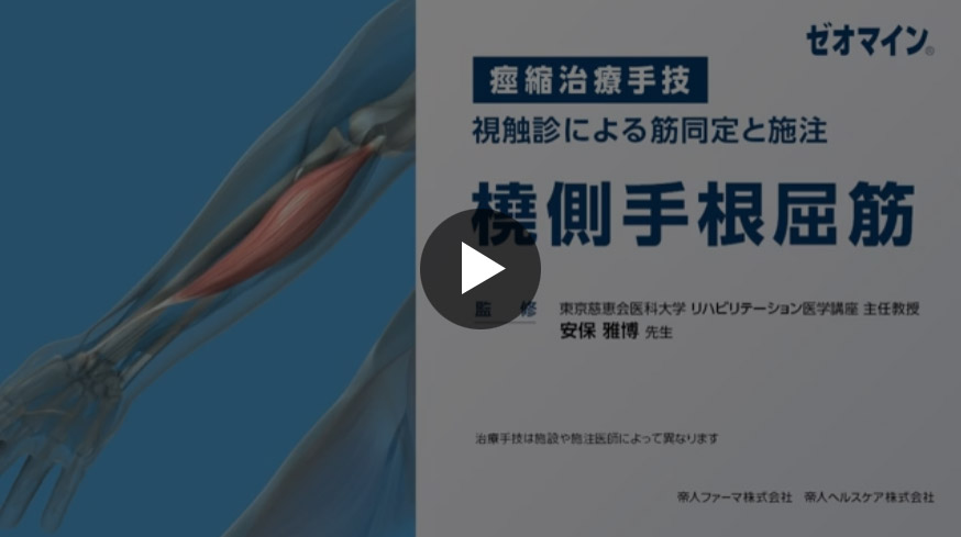 橈側手根屈筋